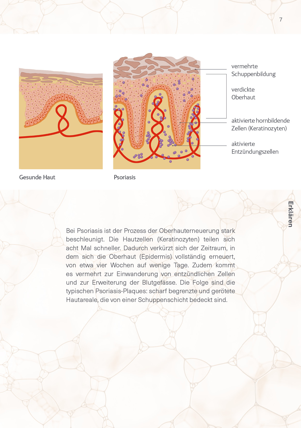 09_2025 AbbVie CH Psoriasis Patientenbroschüre Update_A5_v4_07